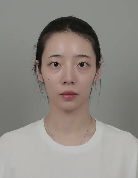 id Hospital - id B&A - Face Contouring Before