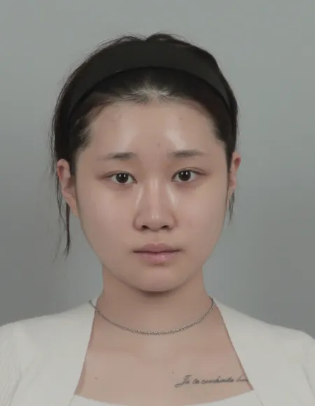 id Hospital - id B&A - Eye,Nose After