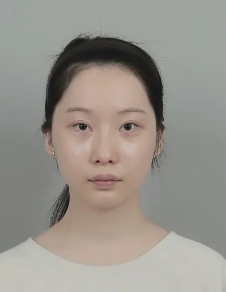 id Hospital - id B&A - Face Contouring,Eye Before