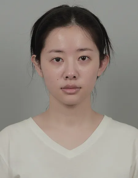 id Hospital - id B&A - Nose Before