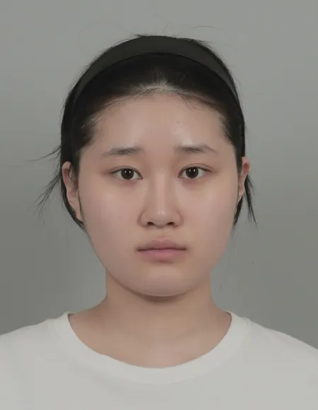 id Hospital - id B&A - Eye,Nose Before