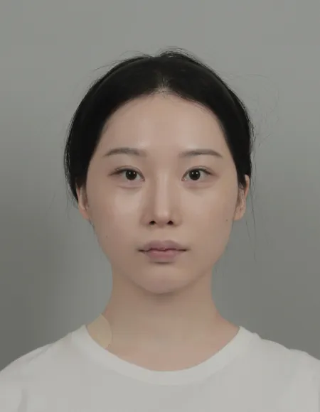 id Hospital - id B&A - Face Contouring,Eye After