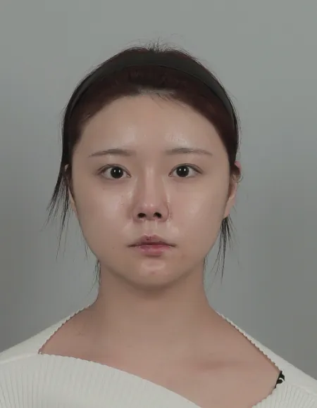 id Hospital - id B&A - Nose,Eye After