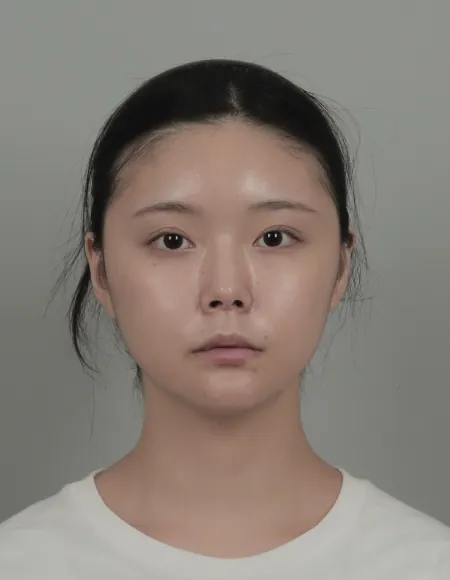 id Hospital - id B&A - Nose,Eye Before