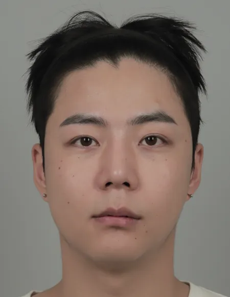 id Hospital - id B&A - Face Contouring,Eye,Nose After