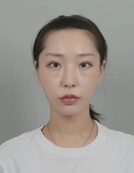 id Hospital - id B&A - Face Contouring,Eye,Nose After