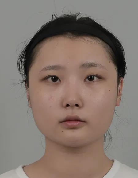 id Hospital - id B&A - Face Contouring,Anti-aging Before