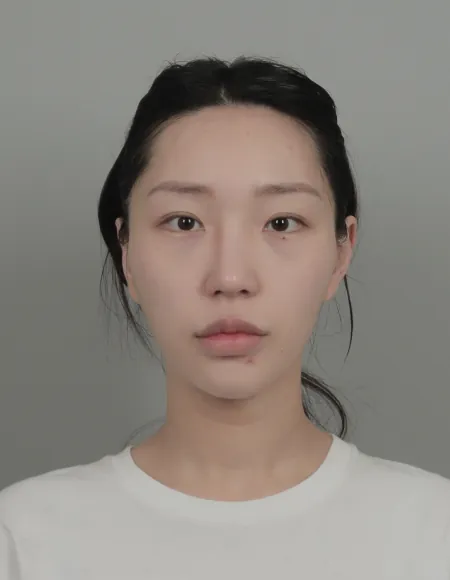 id Hospital - id B&A - Face Contouring,Eye,Nose Before