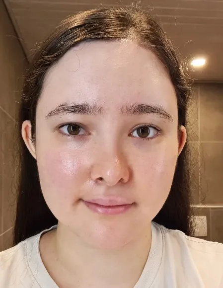 id Hospital - Patient Case Review - After