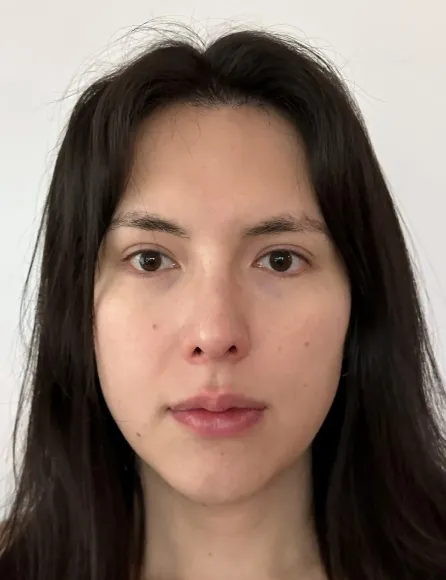 id Hospital - id B&A - [Nose] Nose Surgery & Rhinoplasty After