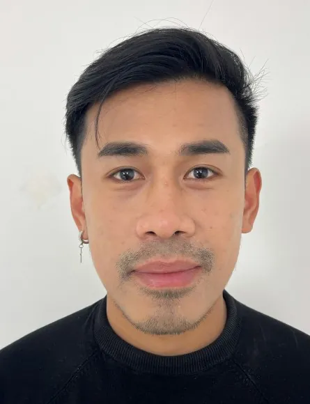 id Hospital - id B&A - [OrthognathicSurgery]JawSurgery+OrthognathicSurgery Before
