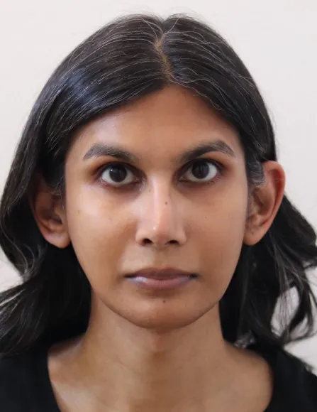 id Hospital - id B&A - [FaceContouring+Nose+Anti-aging]FacialContouring+Rhinoplasty+Facelift After