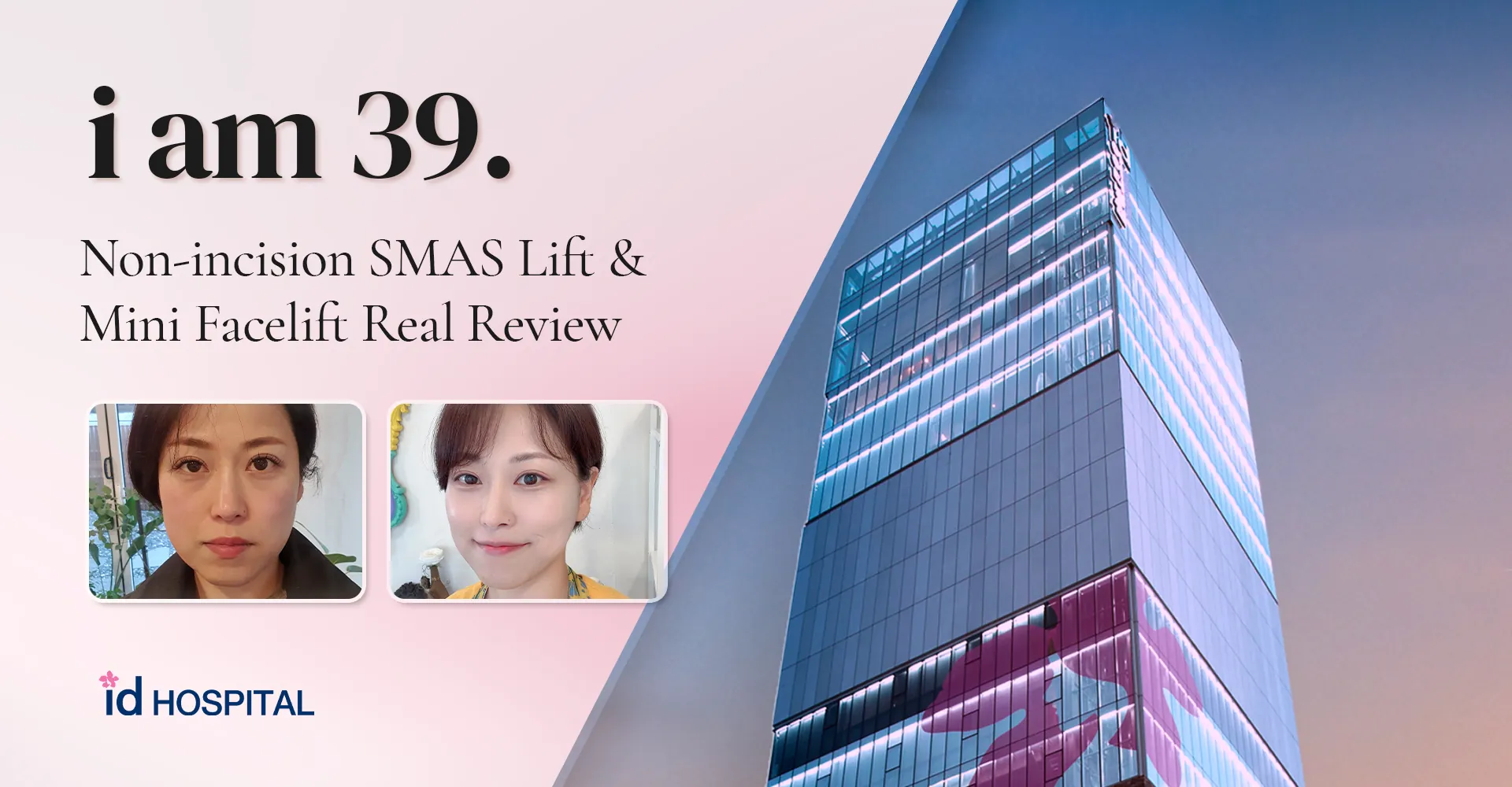 id Hospital - id blog - i am 39. id Premium SMAS Lift & Mini Facelift Real Review
