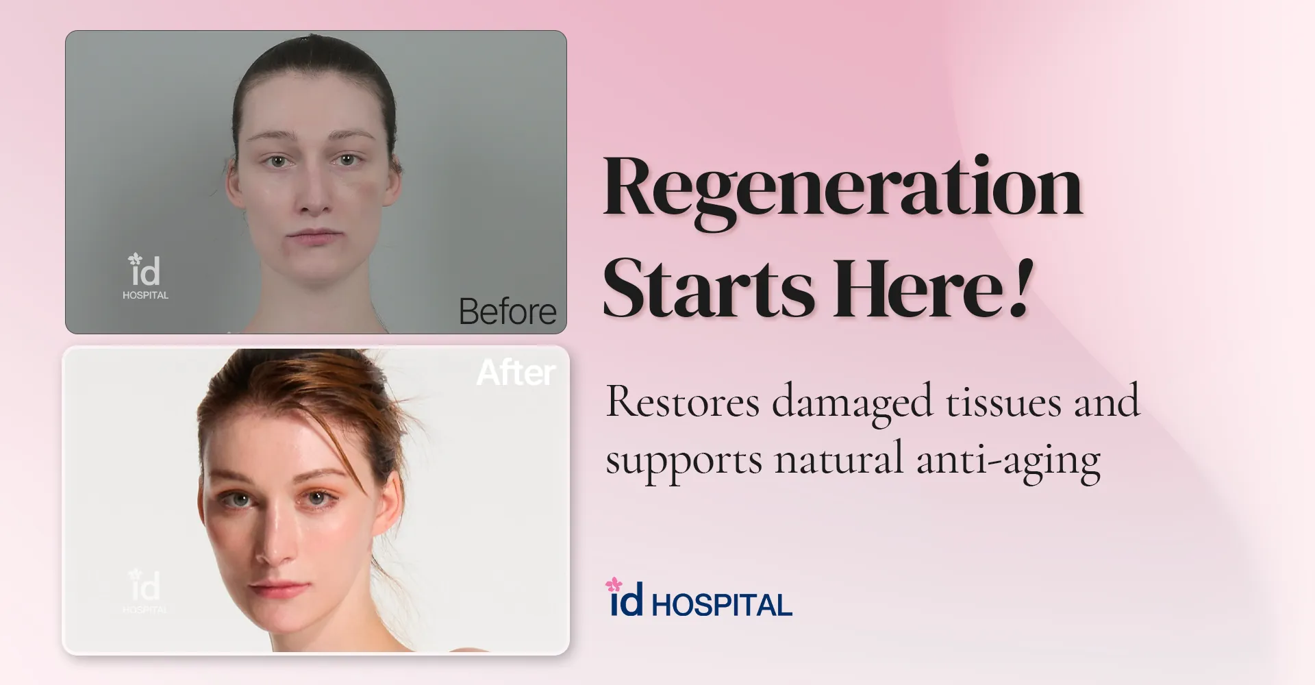 id Hospital - id blog - Beyond Aging: Stem Cell Regenerative Therapy at id Hospital