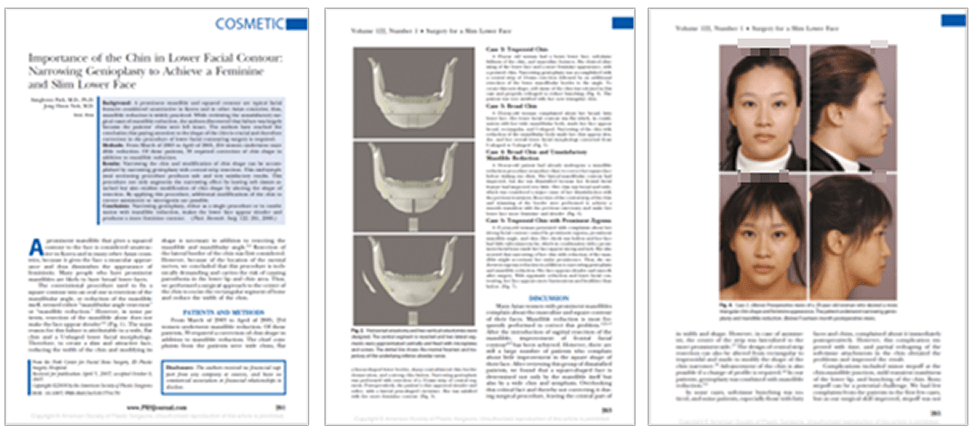 id Hospital - Thesis, research activities - T-Osteotomy