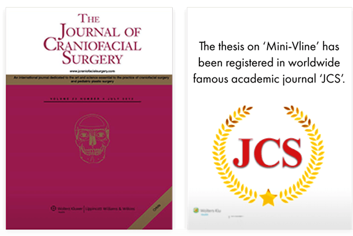 id Hospital - Thesis, research activities - 2014 Mini V-Line