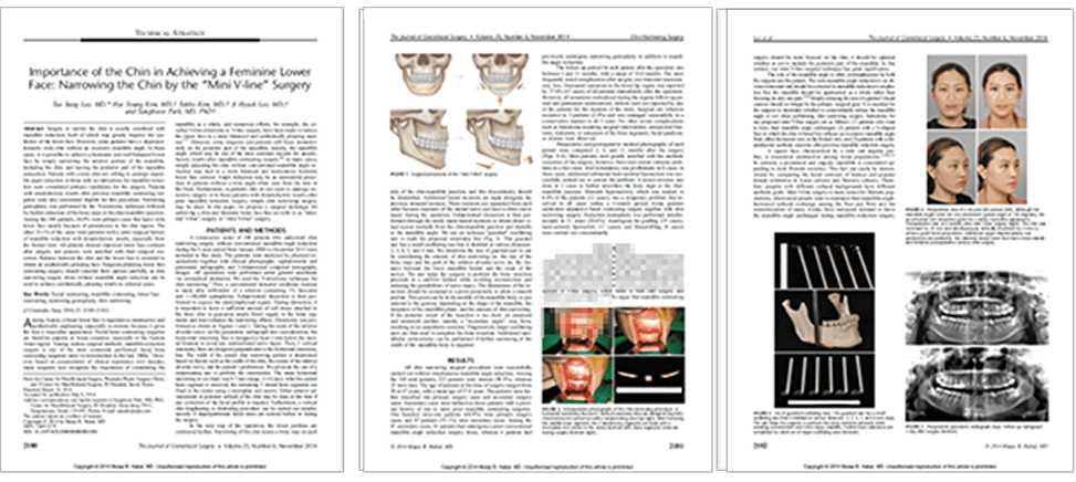 id Hospital - Thesis, research activities - 2014 Mini V-Line