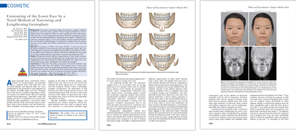 id Hospital - Thesis, research activities - 2014 DIA-Osoteotomy
