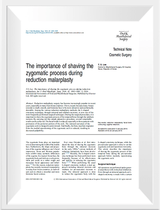 id Hospital - Research for beautiful facial contour - Thesis on Arch shaving Zygoma reduction