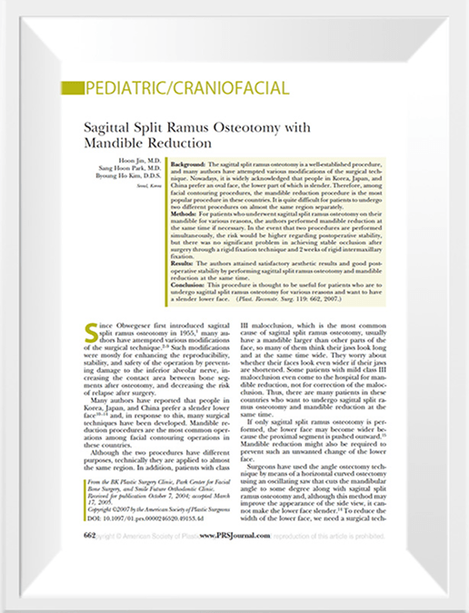 id Hospital - Research for beautiful facial contour - Thesis on Square jaw and Madibular surgery together