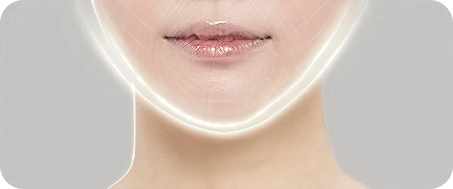 id Hospital - AccuLift - Research on Beautiful Facial Contour