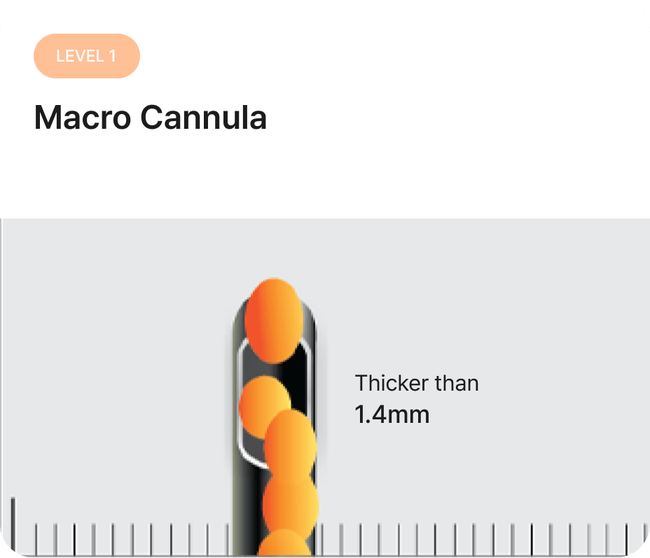 id Hospital - Fat Graft - Macro Cannula Level 1