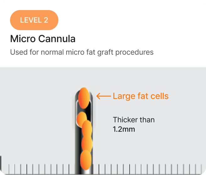 id Hospital - Fat Graft - Macro Cannula Level 2