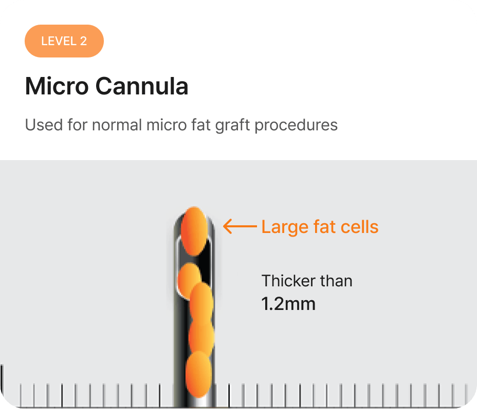 id Hospital - Fat Graft - Macro Cannula Level 2