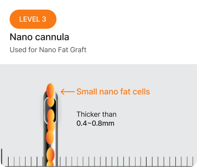 id Hospital - Fat Graft - Macro Cannula Level 3