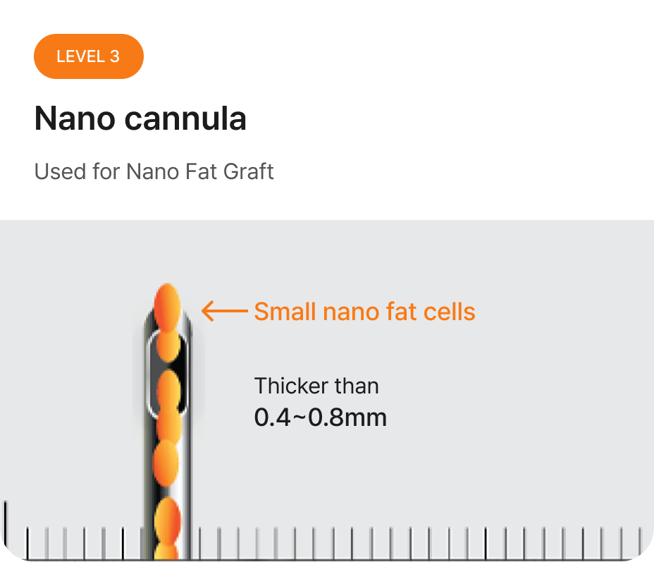 id Hospital - Fat Graft - Macro Cannula Level 3