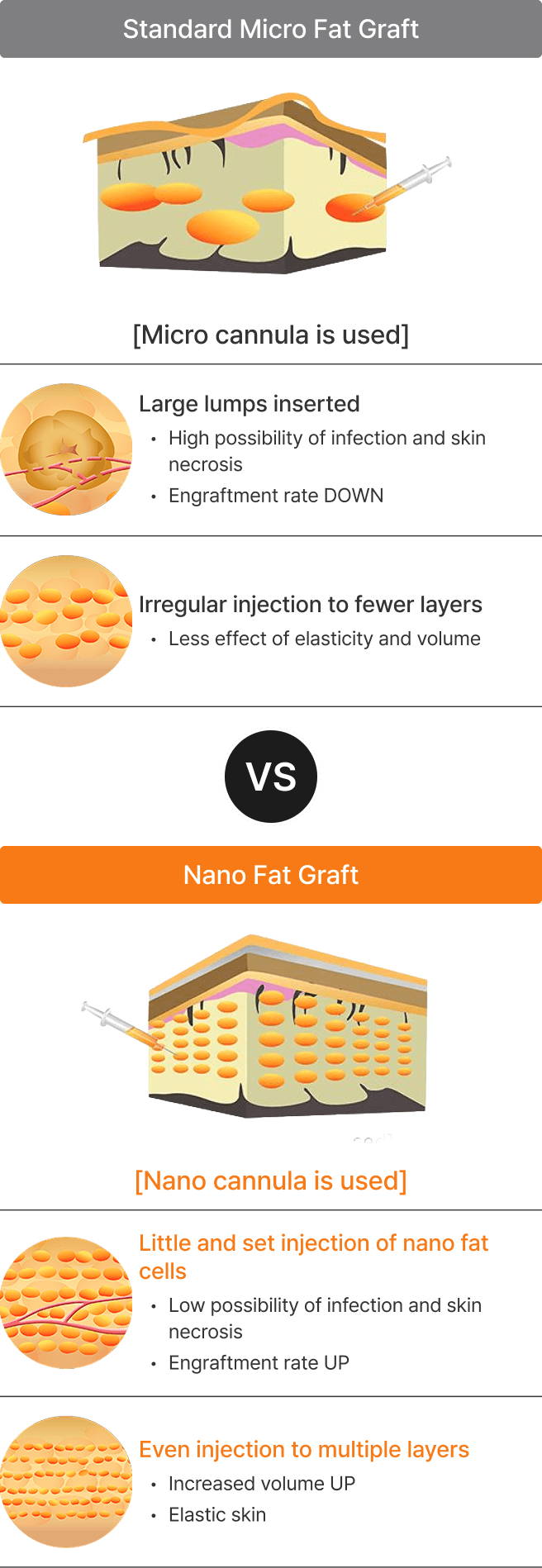 id Hospital - Fat Graft - Even Injection to Multiple Layers