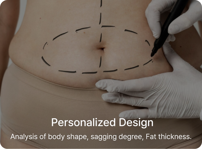 id Hospital - Tummy Tuck - Personalized Design