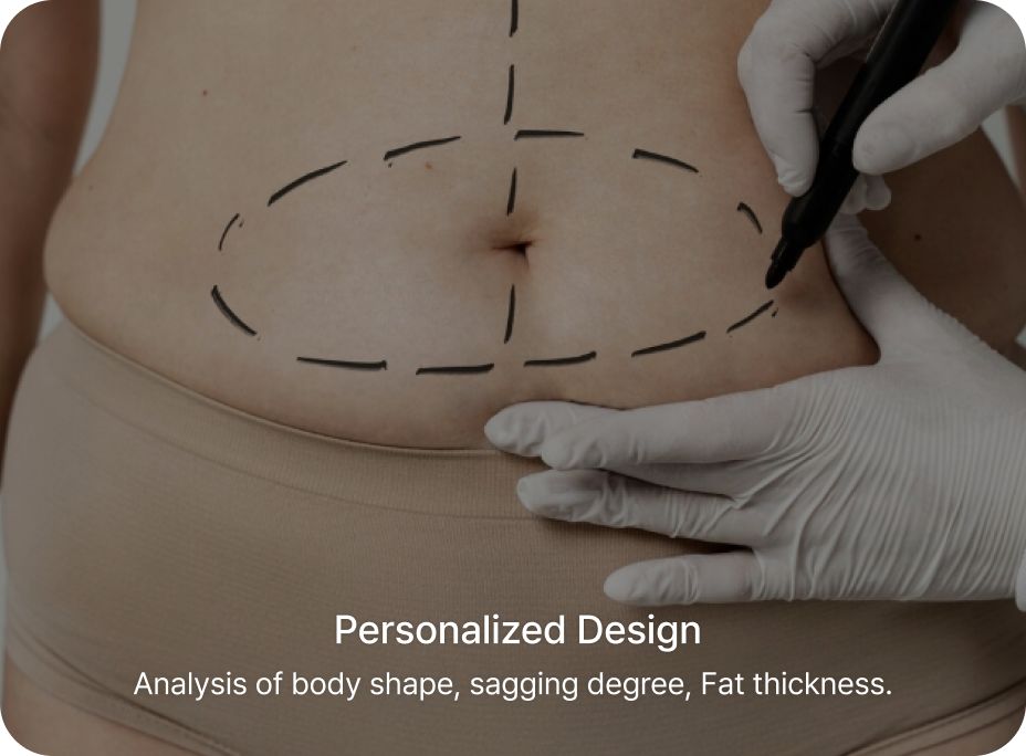 id Hospital - Tummy Tuck - Personalized Design