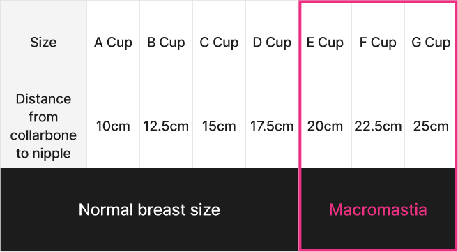 id Hospital - Breast Reduction - Macromastia Self-Diagnosis Test