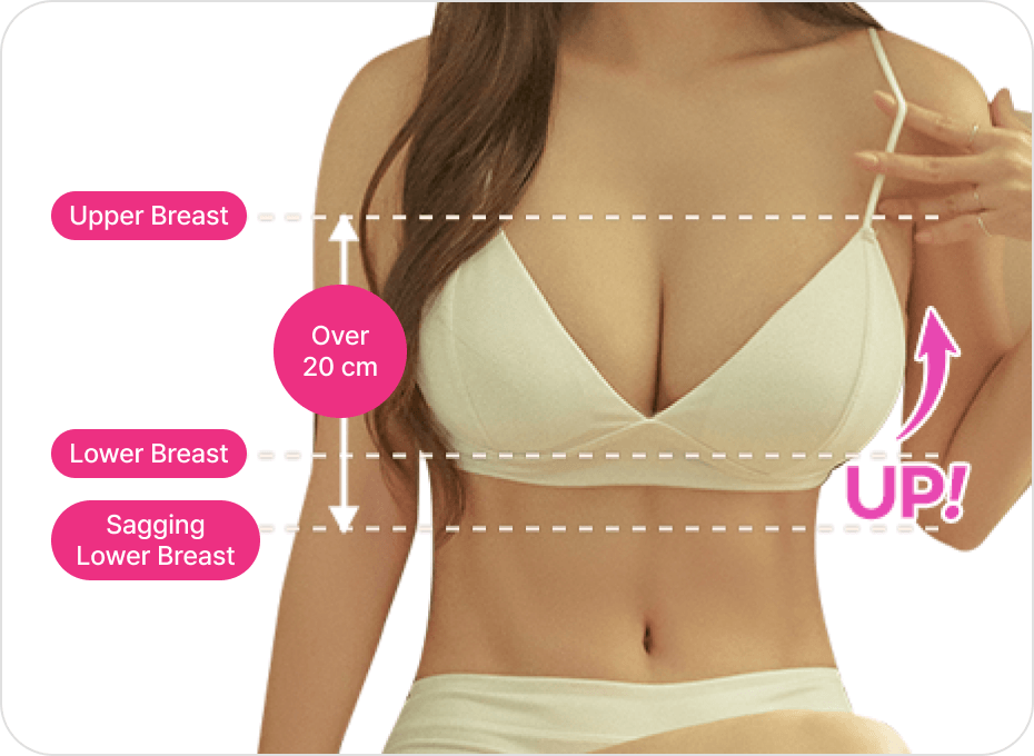 id Hospital - Breast Reduction - Customized Design for Your Body