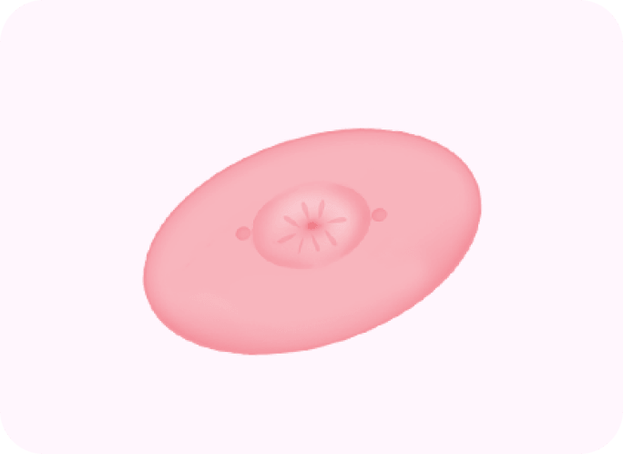 id Hospital - Nipple Correction - Step 1