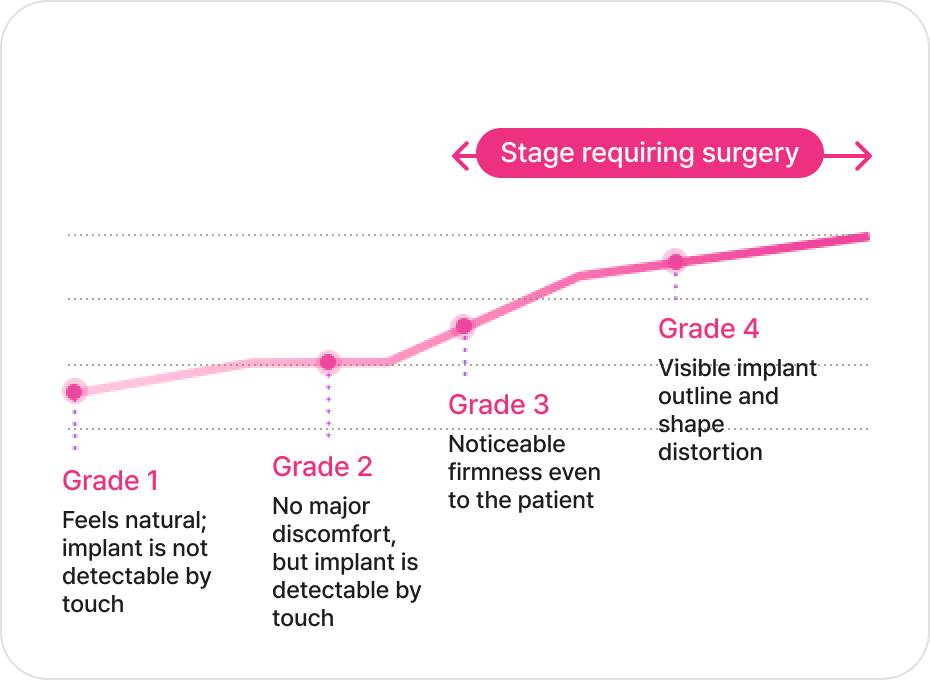 id Hospital - Breast Revision - Stage-by-Stage Symptoms Capsular Contracture