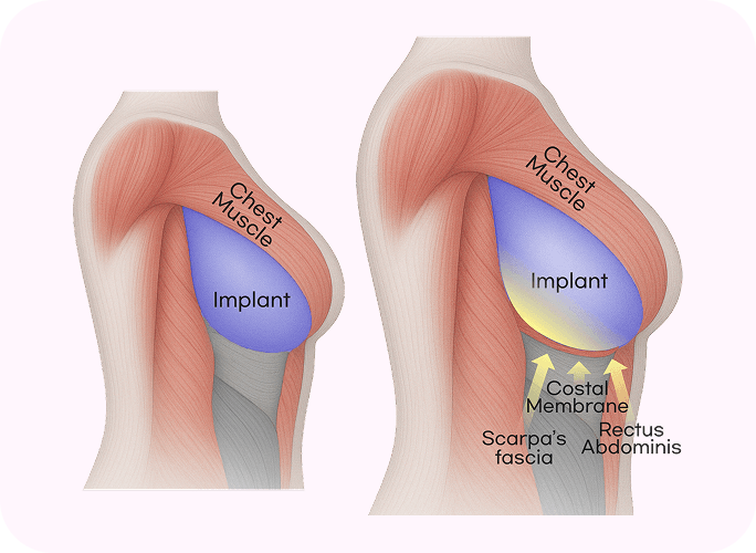 id Hospital - 10 years of Experience - Triple Tightening