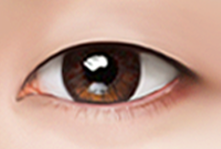 id Hospital - Double Eyelid Surgery - Consultation Step