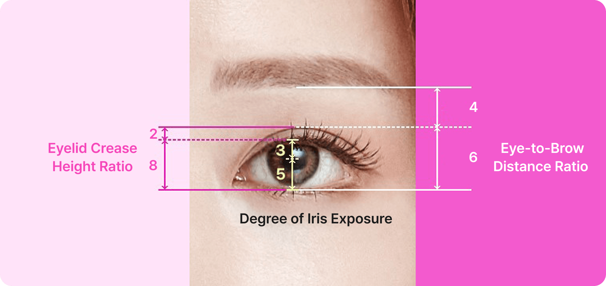id Hospital - Revision Eyelid Surgery - id Revision Surgery Overview