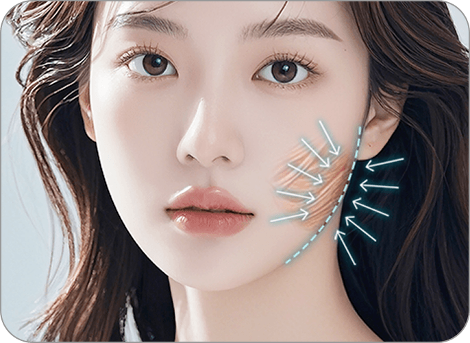 id Hospital - 3 Types of Facial Contouring - Masseter Muscle Reduction