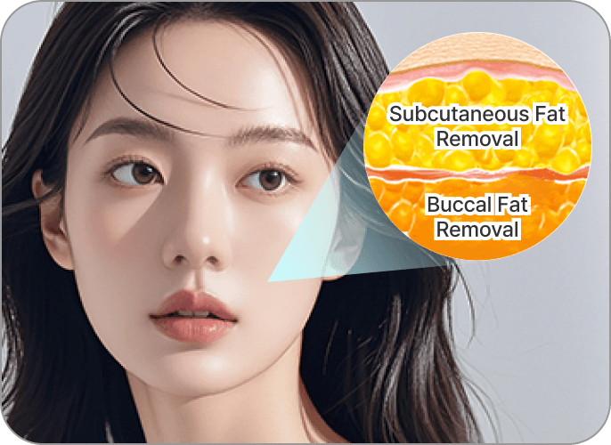 id Hospital - 3 Types of Facial Contouring - Buccal Fat, Fat Removal