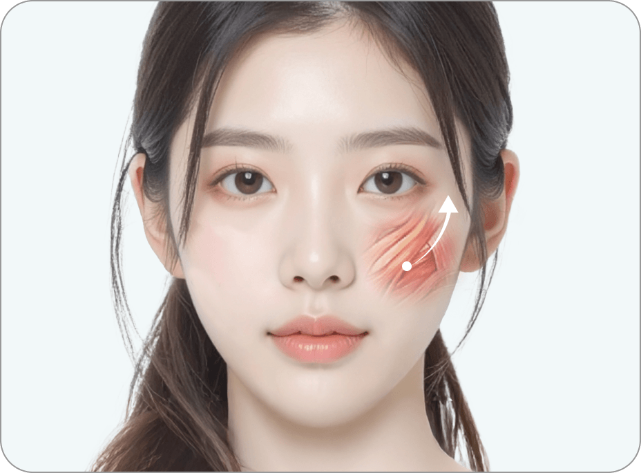 id Hospital - Revision Facial Contouring - Inner Lifting Effect that Reaches up to the Cheeks