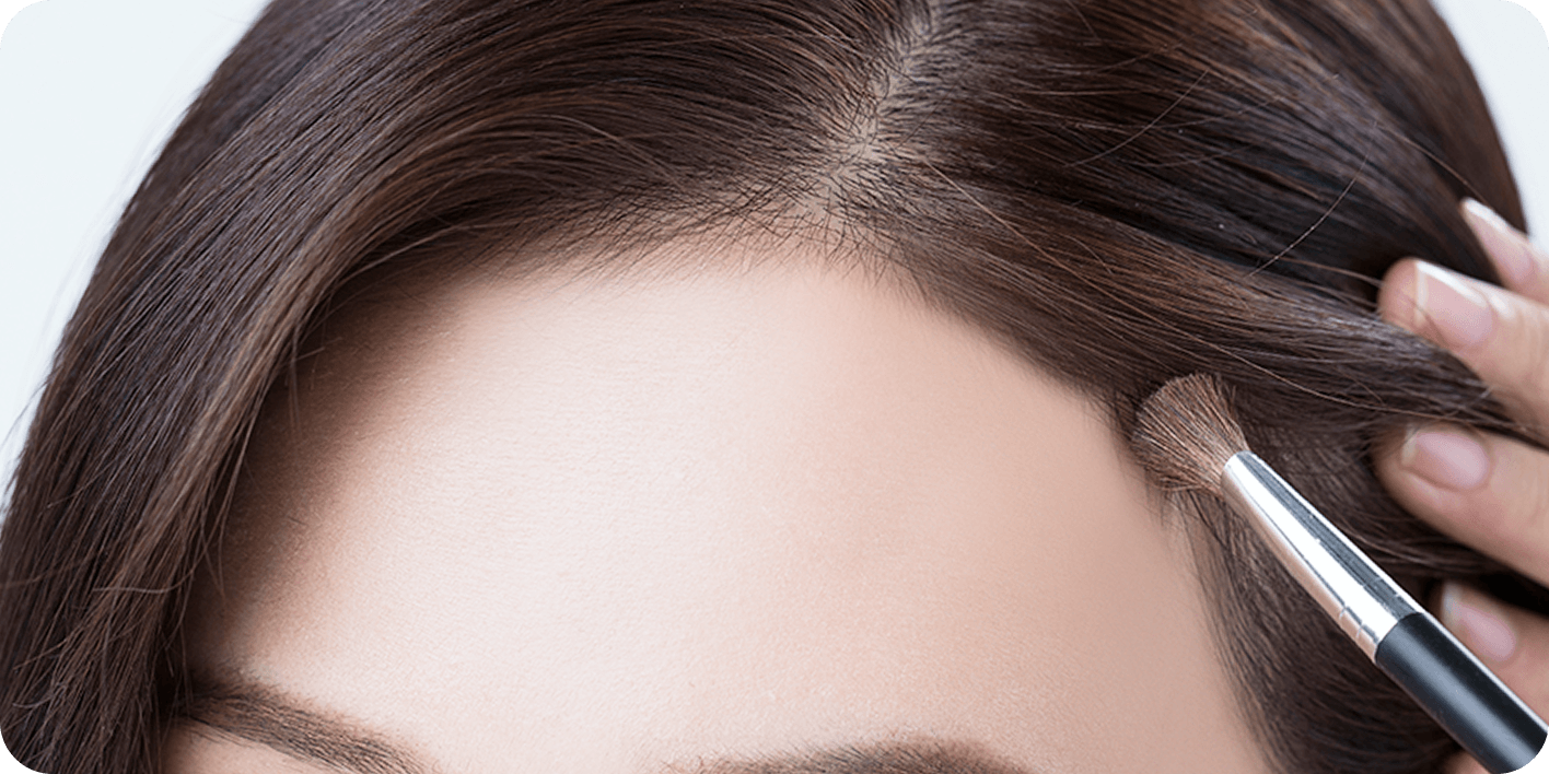 id Hospital - Forehead Reduction - Wide Forehead Before