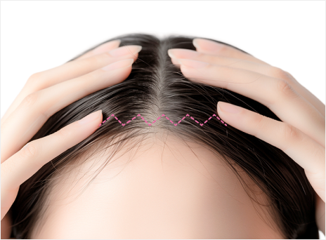 id Hospital - Forehead Reduction - Scar Minimization Protocol