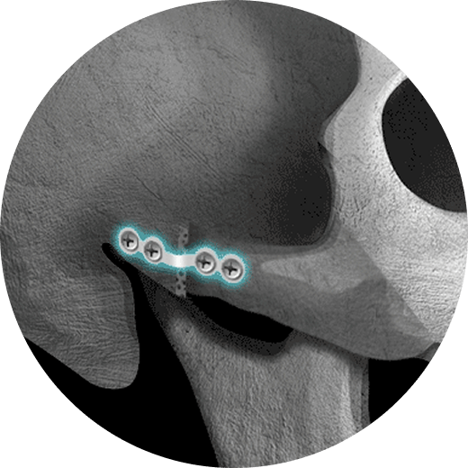id Hospital - 3 Types of Facial Contouring - Complete Fixation!