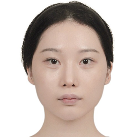 Jawline before