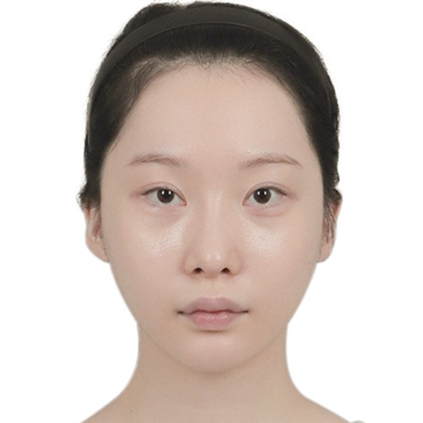 Jawline after