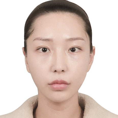 Zygoma after