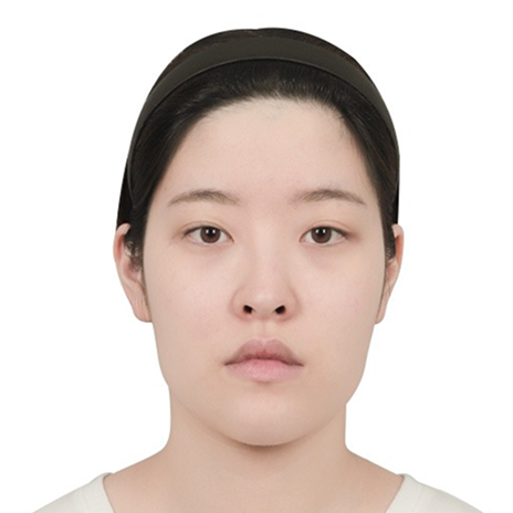 Chin before